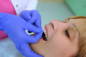 Dentist adhering dental veneers to a patient’s teeth